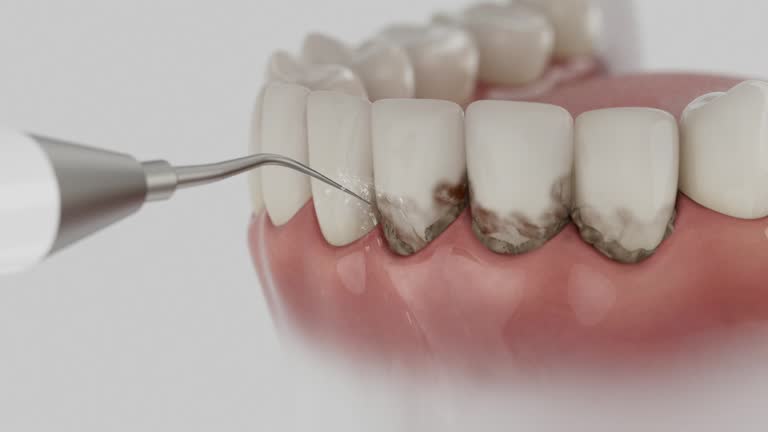 Reliable Dental Implants contractor in Richmond, CA by Smile Center Dentistry